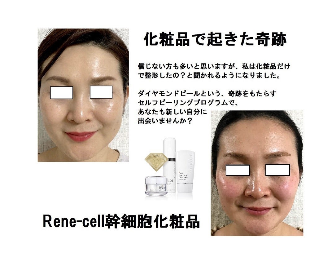 Renecell ルネセル化粧品 新商品 CPRプログラム - その他