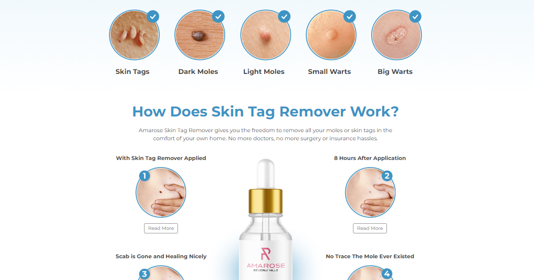 revitol-skin-tag-remover.jimdosite.com