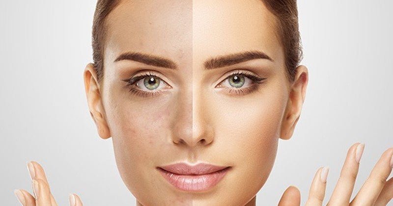 BB-Glow - Behandlungen und Preise | Liebe deinen Körper